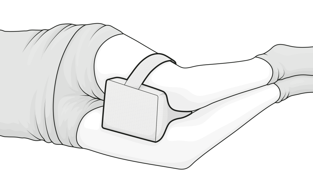 Ilustración de una persona acostada de lado con la almohada para rodillas BODYGUARD® colocada entre las piernas, mejorando la alineación de la columna y la comodidad al dormir.